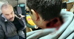 Oğlunu keserek ağır yaralayan babanın kan donduran ifadeleri ortaya çıktı